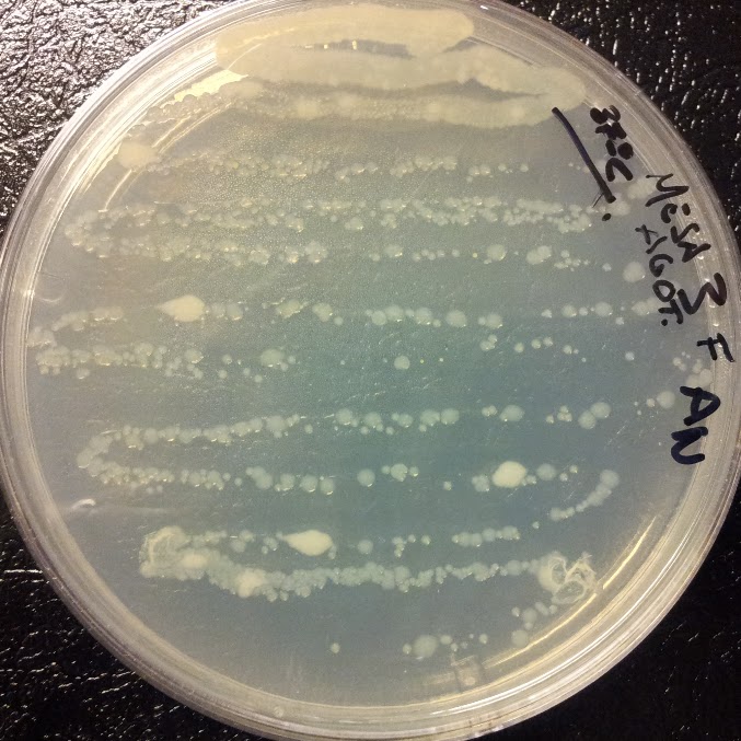 Docencia Microbiolog A Umhtemperatura Pr Cticas Microbiolog A Umh