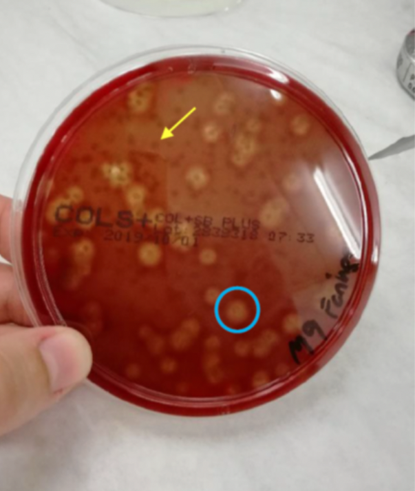 Docencia Microbiología UMHCapacidad hemolítica Prácticas