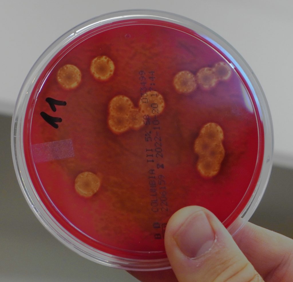 Docencia Microbiolog A Umhcapacidad Hemol Tica Pr Cticas