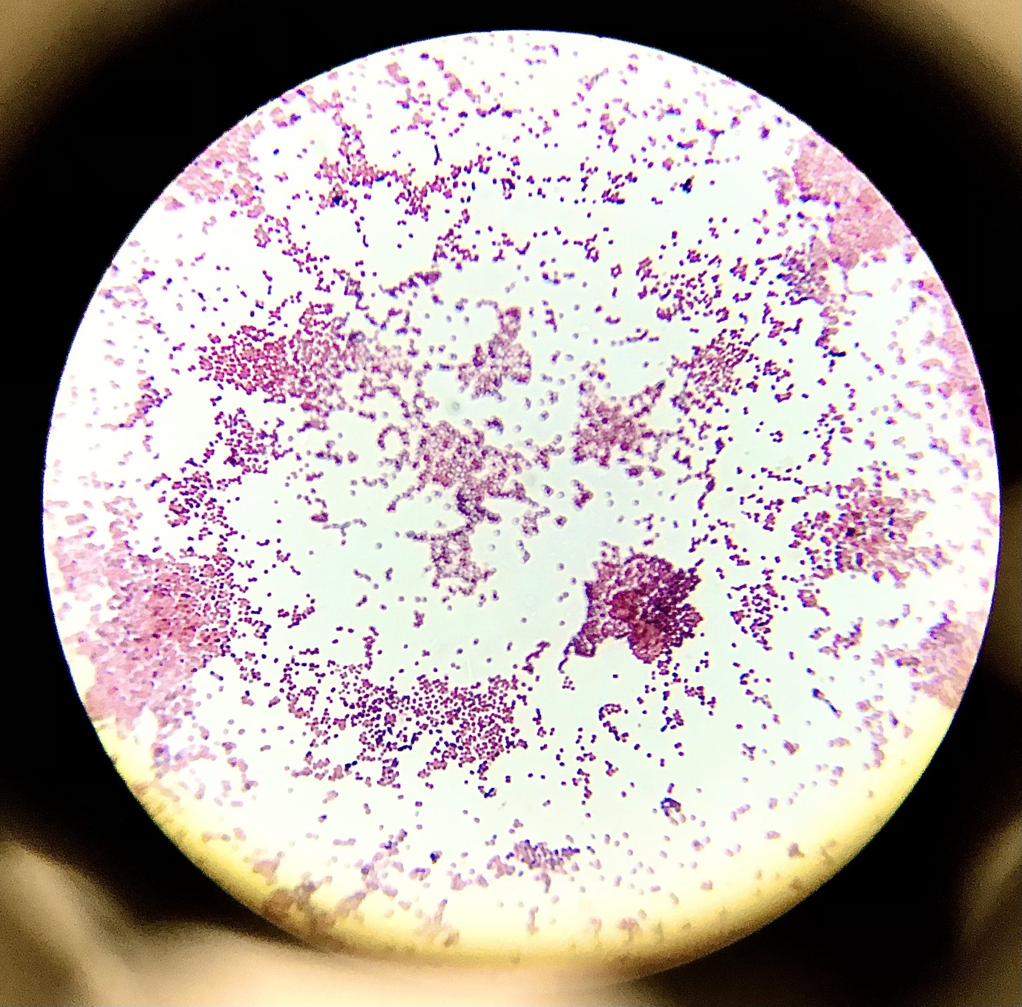 Docencia Microbiolog A Umhtinci N De Gram Pr Cticas Microbiolog A Umh