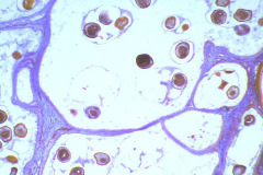 equinococcus-quiste-hidatidico-40x-1