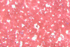 plasmodium-falciparium-4