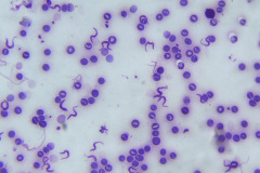 tripanosoma-brucei-gambiensis-3-1